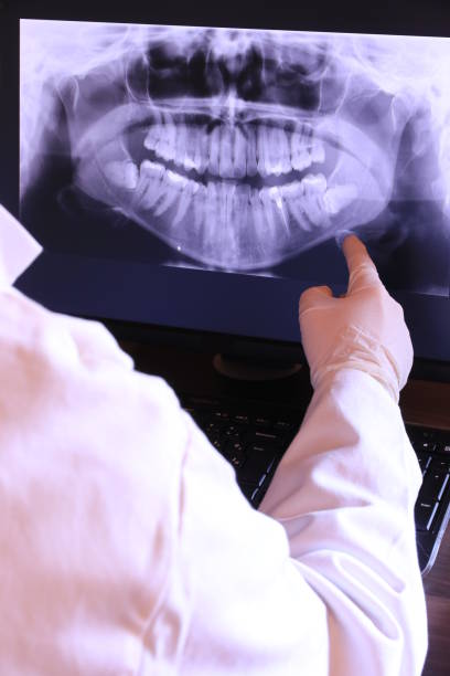 Best Emergency Root Canal Treatment in Greenwood, MO