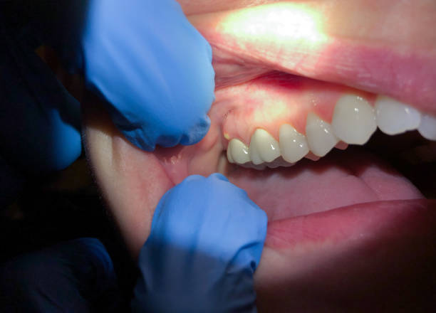 Best Weekend Emergency Dentist in Greenwood, MO