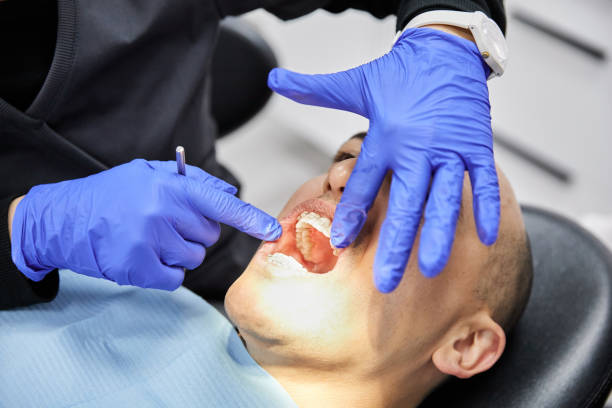 Best Emergency Dental Services for Seniors in Greenwood, MO