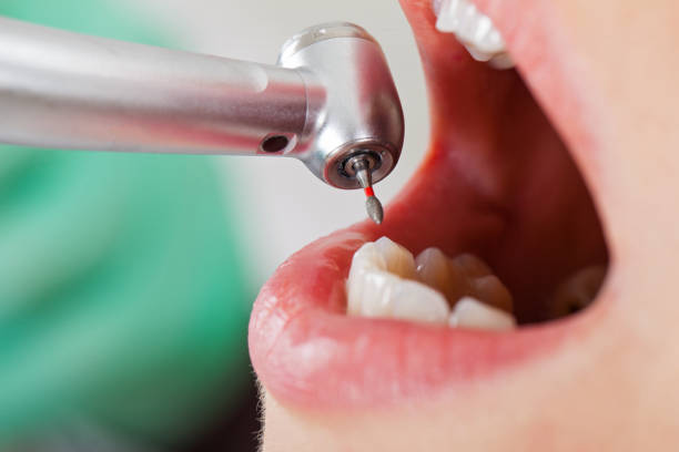 Best Broken or Cracked Tooth Emergency Dentist in Greenwood, MO